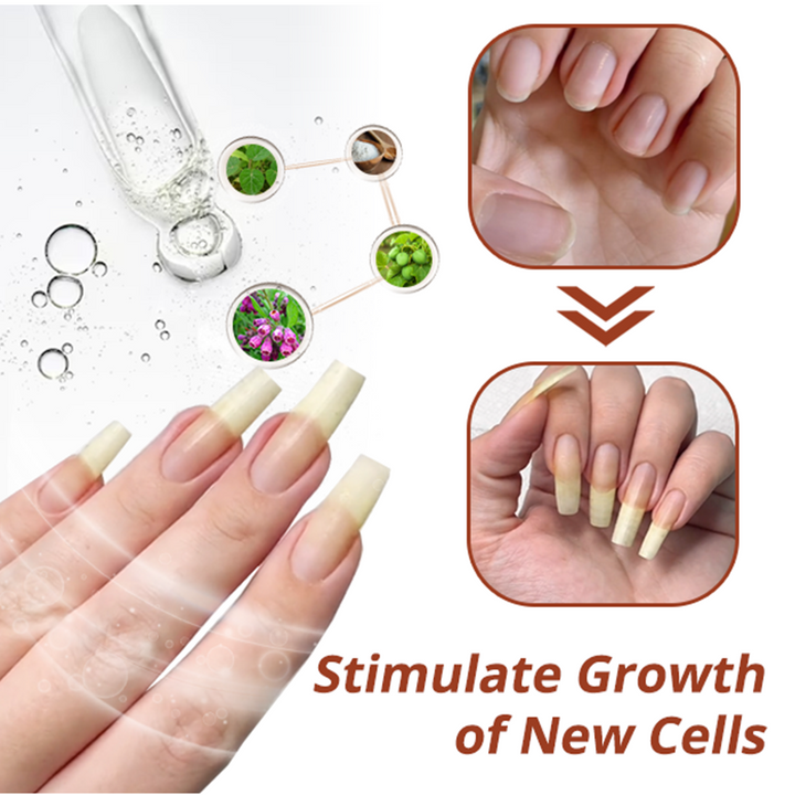 GFOUK™ 7 Days Nail Growth and Strengthening Serum