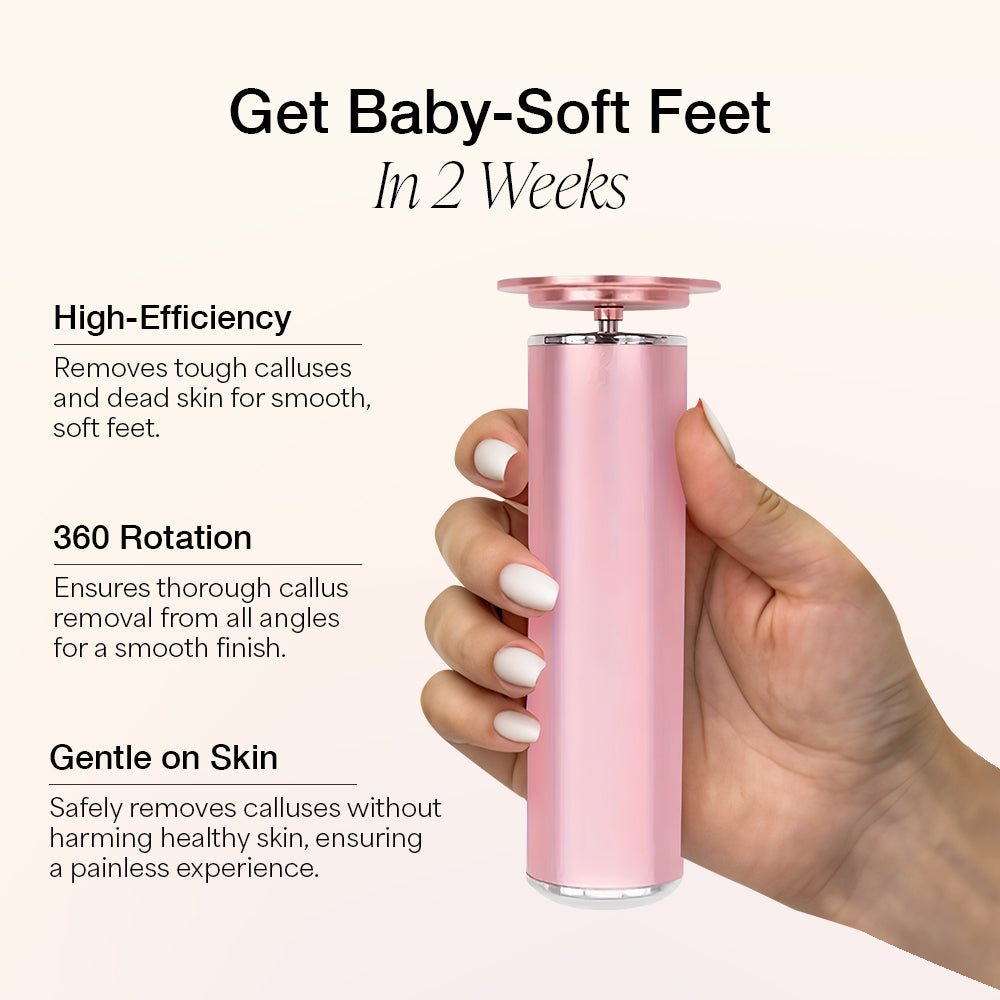 Baby feet™ Electric Foot Callus Remover